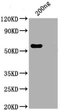 Western blot using anti-Cov19 Nucleaocapsid protein N